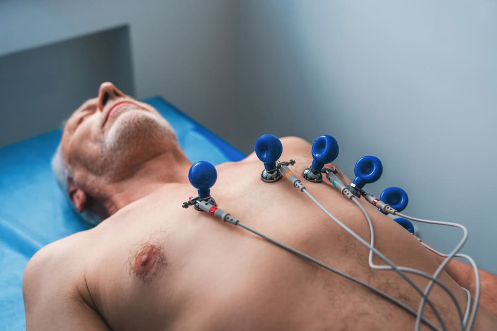 Servicios de cardiología