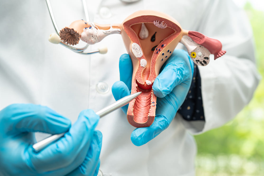 Cómo prevenir el hongo vaginal