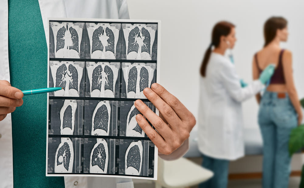 unidad de neumología