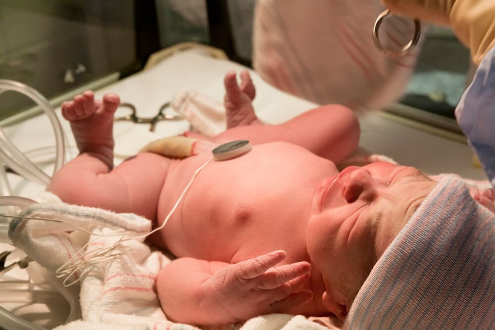 Unidad de Cuidados Intensivos Neonatales