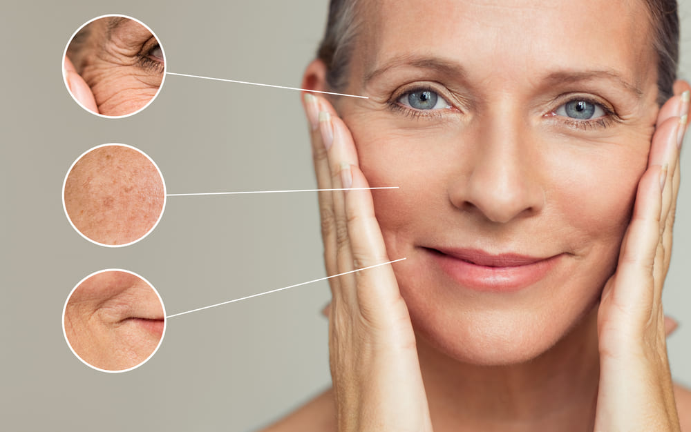Endolifting facial láser