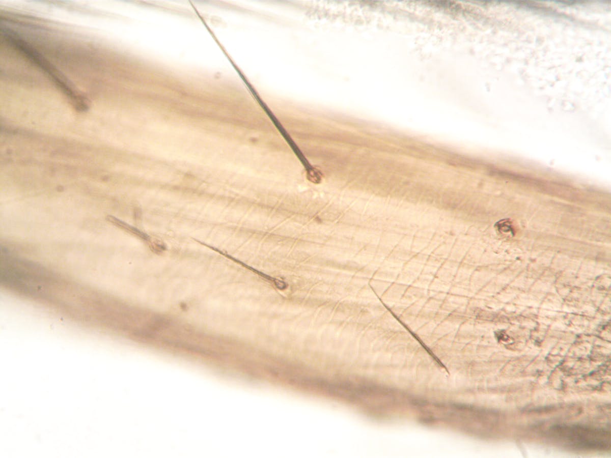 microscopic view of the structure